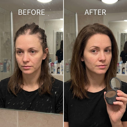 RootRescue™ - Hide your thinning hair instantly without anyone ever finding out.